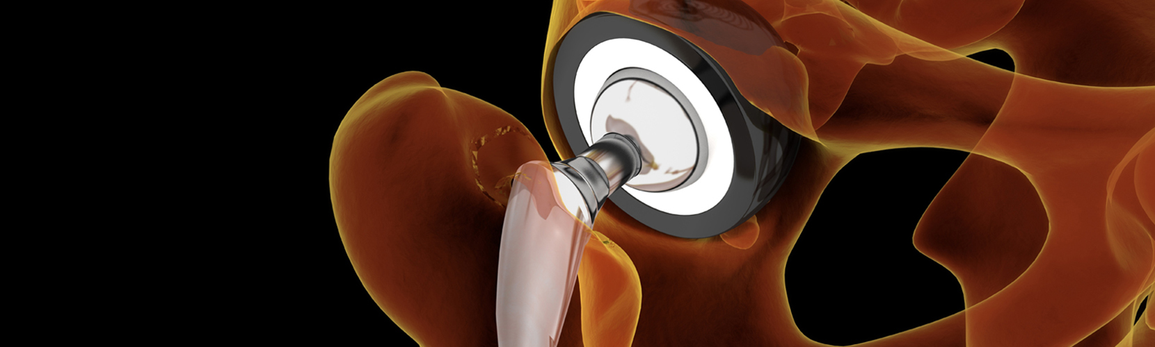 Close up of a Hip bone