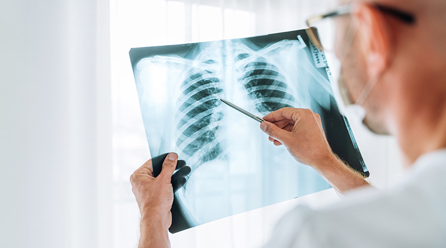 A doctor wearing glasses points to a chest X-ray with a pen, highlighting the lungs and ribcage for evaluation. 